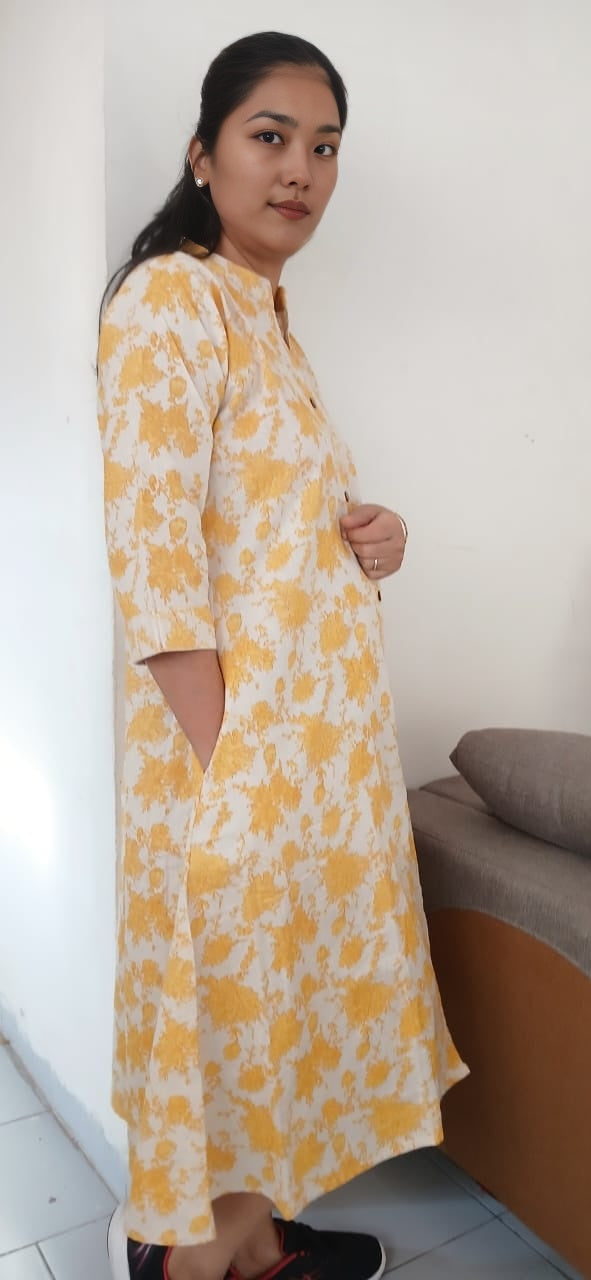 2 YELLOW PRINT MIDI DRESS